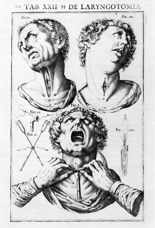 La prima monografia scientifica sulla laringe e sull'orecchio - 1600-1601